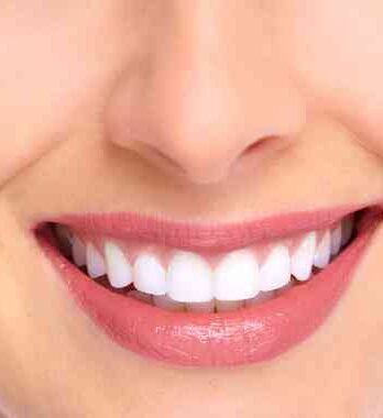 How A Stunning Smile Can Transform Your Life