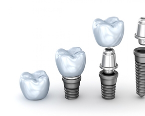 NuClam and Nitrous Sedation to Chase Away Your Anxiety at the Dental Clinic