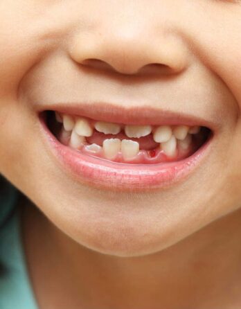 Tiny Tooth Troubles: Pediatric Dental Issues And Solutions