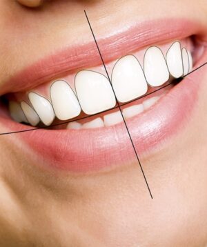 Digital Smile Design